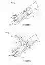 Fig. 03 - Apparatus and method for heart valve repair