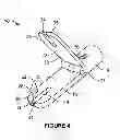 Fig. 04 - Apparatus and method for heart valve repair