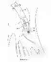 Fig. 07 - Apparatus and method for heart valve repair
