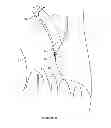 Fig. 08 - Apparatus and method for heart valve repair