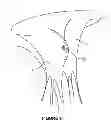 Fig. 09 - Apparatus and method for heart valve repair