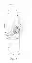 Fig. 02 - KNEE PROSTHESIS