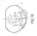 Fig. 12 - KNEE PROSTHESIS