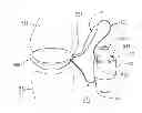 Fig. 01 - Tumid implant and pump