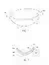 Fig. 02 - Tumid implant and pump
