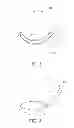 Fig. 03 - Tumid implant and pump