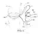 Fig. 04 - Tumid implant and pump