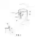 Fig. 05 - Tumid implant and pump
