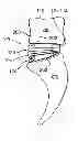 Fig. 01 - Stabilizing vertebrae with expandable spacers
