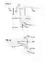 Fig. 05 - Implants for spinal therapy