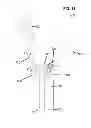 Fig. 15 - Implants for spinal therapy