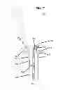 Fig. 16 - Implants for spinal therapy