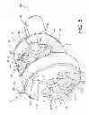 Fig. 05 - Rotatable reverse metaglene kit