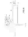 Fig. 08 - Rotatable reverse metaglene kit
