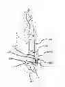 Fig. 01 - ARTIFICIAL IMPLANT FOR CARPOMETACARPAL JOINT