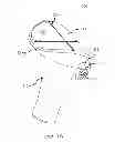 Fig. 02 - ARTIFICIAL IMPLANT FOR CARPOMETACARPAL JOINT