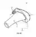 Fig. 03 - ARTIFICIAL IMPLANT FOR CARPOMETACARPAL JOINT