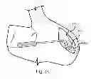Fig. 04 - ARTIFICIAL IMPLANT FOR CARPOMETACARPAL JOINT