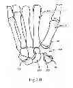 Fig. 05 - ARTIFICIAL IMPLANT FOR CARPOMETACARPAL JOINT