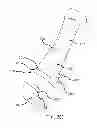 Fig. 06 - ARTIFICIAL IMPLANT FOR CARPOMETACARPAL JOINT