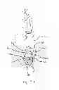 Fig. 07 - ARTIFICIAL IMPLANT FOR CARPOMETACARPAL JOINT