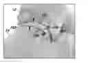Fig. 01 - Joint Arthroplasty Systems, Methods, and Components