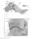 Fig. 02 - Joint Arthroplasty Systems, Methods, and Components