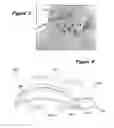 Fig. 03 - Joint Arthroplasty Systems, Methods, and Components