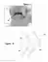 Fig. 09 - Joint Arthroplasty Systems, Methods, and Components