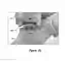 Fig. 22 - Joint Arthroplasty Systems, Methods, and Components
