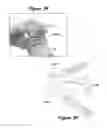 Fig. 29 - Joint Arthroplasty Systems, Methods, and Components