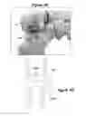 Fig. 35 - Joint Arthroplasty Systems, Methods, and Components