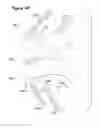 Fig. 37 - Joint Arthroplasty Systems, Methods, and Components