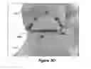 Fig. 42 - Joint Arthroplasty Systems, Methods, and Components