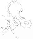Fig. 02 - MONOBLOCK HEAD AND NECK UNIT FOR TOTAL HIP REPLACEMENT