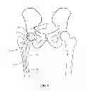 Fig. 02 - Methods and devices for a surgical hip replacement procedure