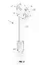 Fig. 04 - Methods and devices for a surgical hip replacement procedure