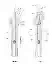 Fig. 07 - Methods and devices for a surgical hip replacement procedure
