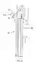 Fig. 10 - Methods and devices for a surgical hip replacement procedure