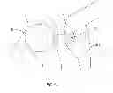 Fig. 12 - Methods and devices for a surgical hip replacement procedure