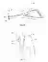 Fig. 13 - Methods and devices for a surgical hip replacement procedure