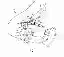 Fig. 02 - Method of determining a steering angle in a motor vehicle