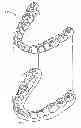 Fig. 01 - System for determining final position of teeth