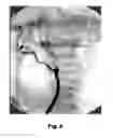 Fig. 06 - PREOPERATIVE SURGICAL SIMULATION