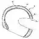 Fig. 01 - Brain cooling device