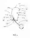Fig. 04 - Handy Wiping Tool