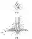 Fig. 04 - Apparatus and method for cleaning air filters