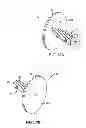 Fig. 06 - Non-penetrating anchor system and method