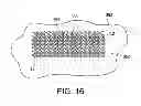 Fig. 07 - Fastener member for affixation to a structure in an orthopedic device and method for securing the same