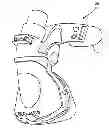 Fig. 01 - Forehead-contacting device for a breathing mask and method for making the same
